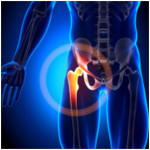 natural treatment for hip pain