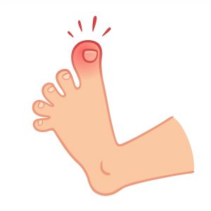 Foot with toe pain